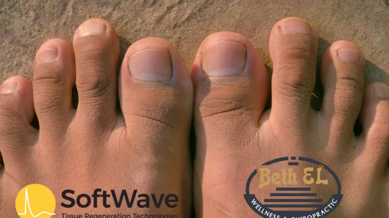 A Breakthrough for Morton's Neuroma at Beth EL Wellness & Chiropractic with SoftWave Tissue Regeneration Technology (TRT)